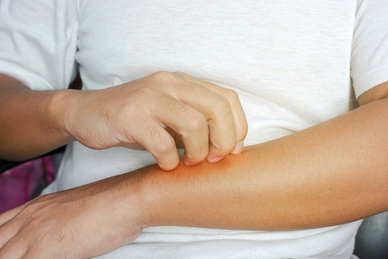 Le Psoriasis